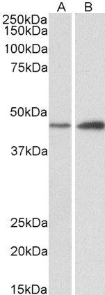 NDRG2 antibody