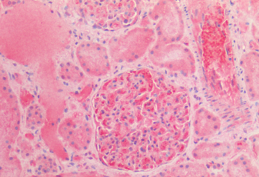 Alpha 1 Fetoprotein antibody