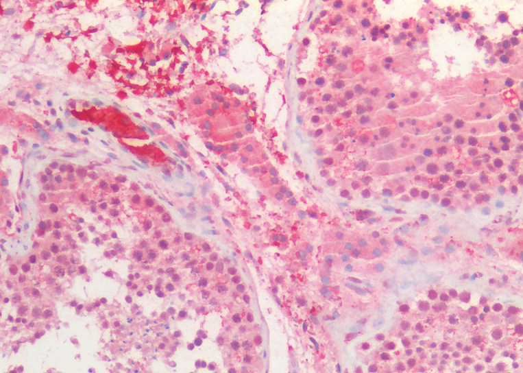 Goat anti-BMI1 (aa237-251) Antibody
