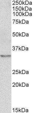 tropomyosin 4/TPM4 Antibody