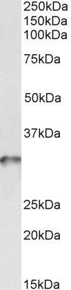 Goat anti-tropomyosin 4 / TPM4 Antibody