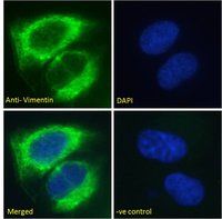 Vimentin antibody