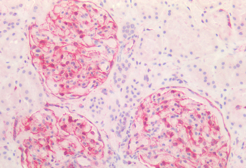 Vimentin antibody