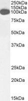 Goat anti-ICAM1 (aa313-327) Antibody