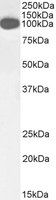 ICAM1 antibody