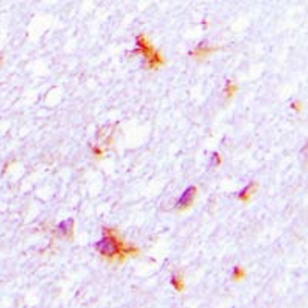 CYSLTR1 Antibody