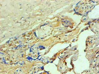 Hemoglobin Antibody