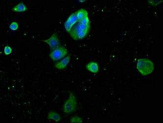 Myoglobin antibody