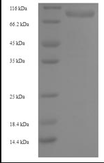 Human RRM1 protein