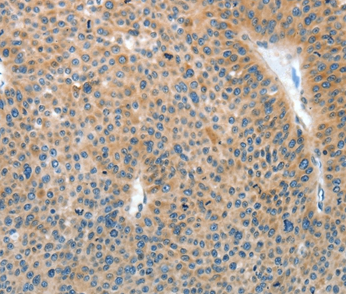 IL22RA1 Rabbit Polyclonal Antibody