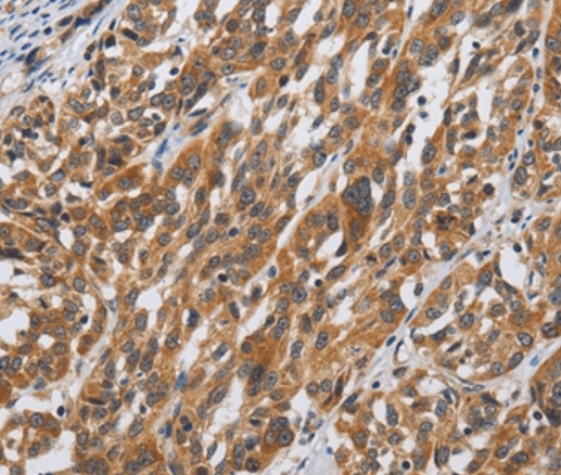 DSP Antibody