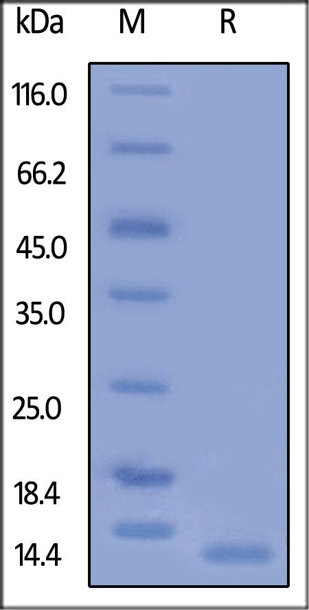 Human CD9 Protein, His Tag
