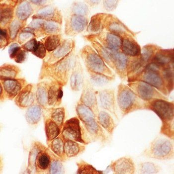 Anti-Cytokeratin 19/KRT19 Antibody
