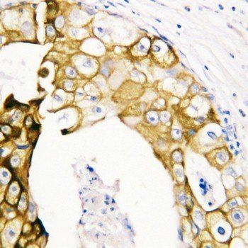 Anti-Cytokeratin 19/KRT19 Antibody