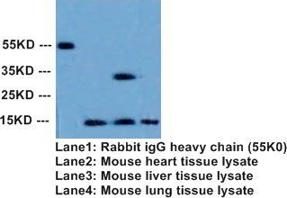 Superoxide Dismutase 1/SOD1 Antibody