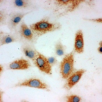 Anti-P-Cadherin-3 CDH3-Antibody