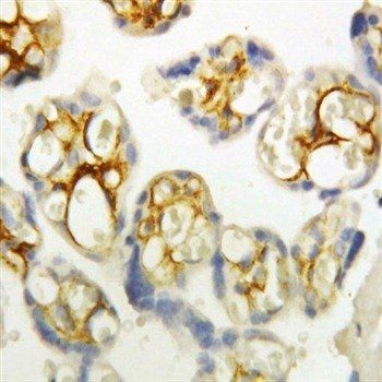 Anti-P-Cadherin-3 CDH3-Antibody