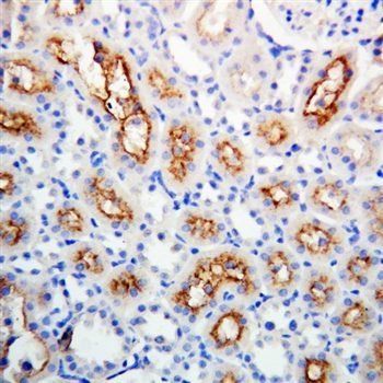 Anti-Connexin 32/GJB1 Antibody