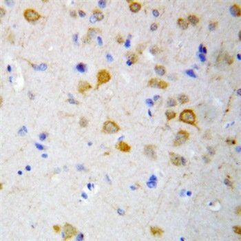 Anti-5HT2A Receptor/HTR2A Antibody