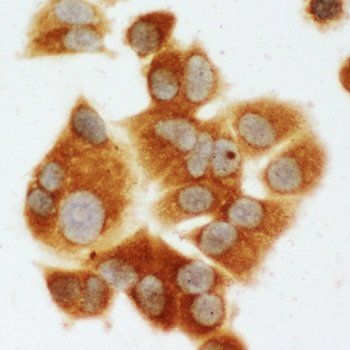 Anti-MEK1/MAP2K1 Antibody