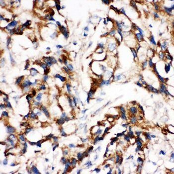 Anti-MEK1/MAP2K1 Antibody