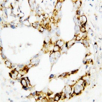Anti-MEK3/MAP2K3 Antibody