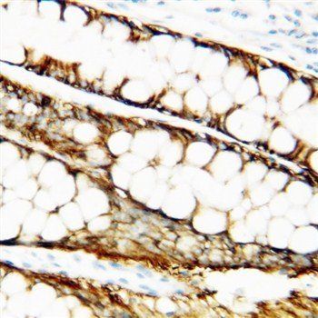 Metalloproteinase inhibitor 1 TIMP1 Rabbit Polyclonal Antibody