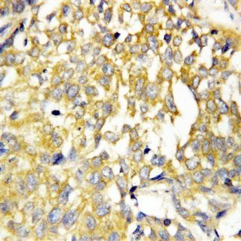 Anti-Pleiotrophin/PTN Antibody