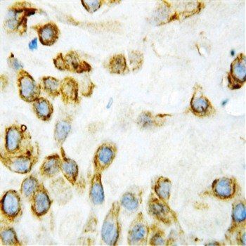 Anti-Thrombospondin 2/THBS2 Antibody