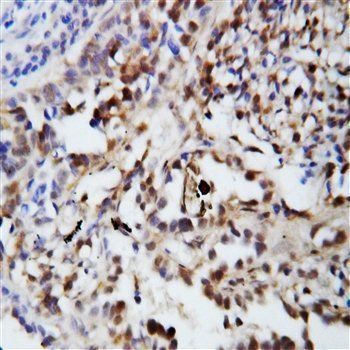 Anti-Ubiquitin/UBB Antibody