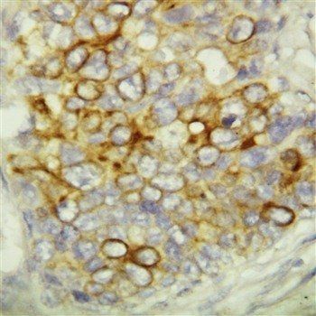 Anti-Caspase-6(P18)/CASP6 Antibody