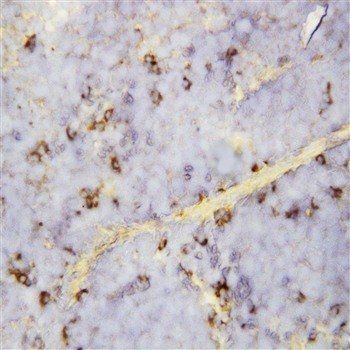 Anti-C-X-C motif chemokine 16 CXCL16 Antibody