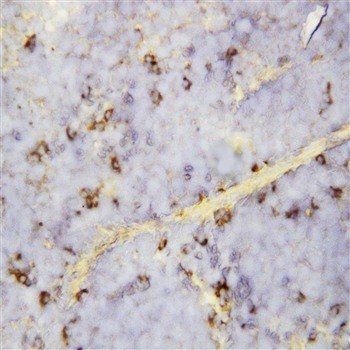 C-X-C motif chemokine 16 CXCL16 Antibody