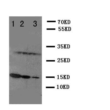 Interleukin-2 IL2 Antibody