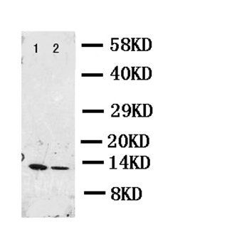 Resistin/RETN Rabbit Polyclonal Antibody