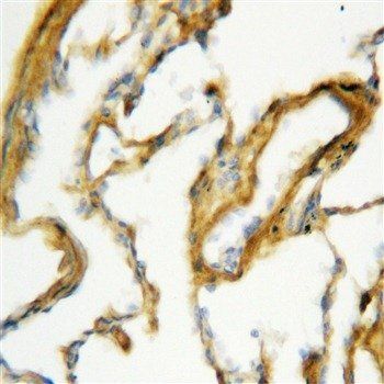 Anti-SFTPA1 Antibody