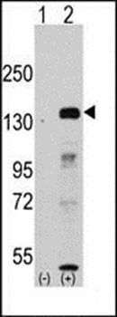 JHDM1a/FBXL11 antibody