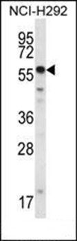 SMYD2 antibody