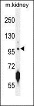ATPGD1 antibody
