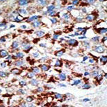 UBE1C antibody