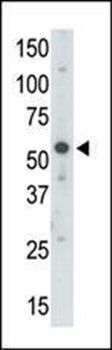 UBE1C antibody