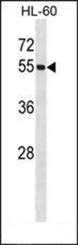 UBE1C antibody