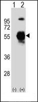 UBE1C antibody