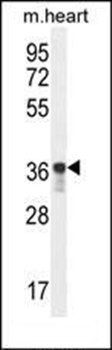 GPD1L antibody