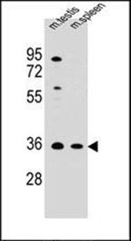 ASB17 antibody