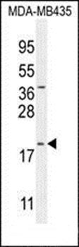 CT173 antibody