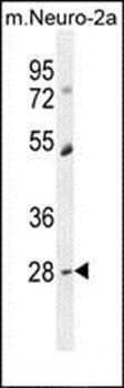 RP11-529I10.4 antibody