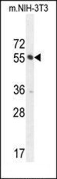 CTDSPL2 antibody