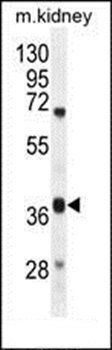 DUS4L antibody