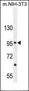 CCDC39 antibody